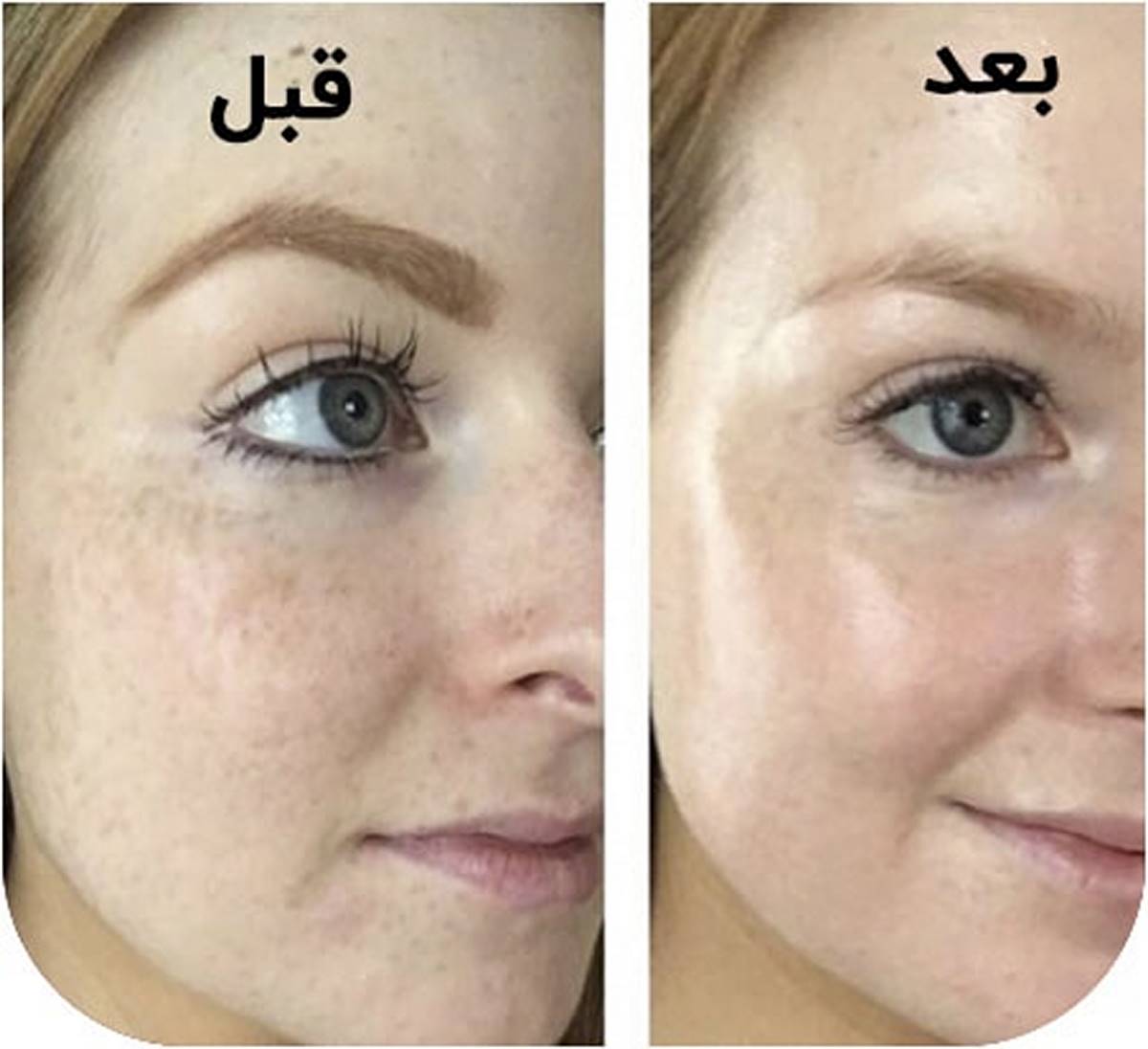سرم رتینال گیک اند گورجس
